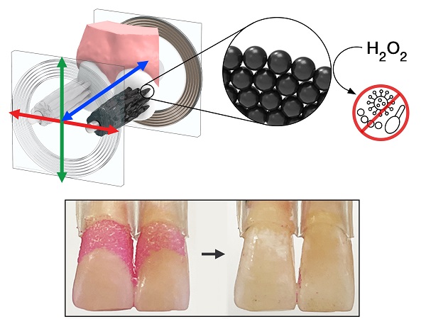 Arranged in bristle-like structures, a robotic microswarm of iron oxide nanoparticles effectively cleaned plaque from teeth