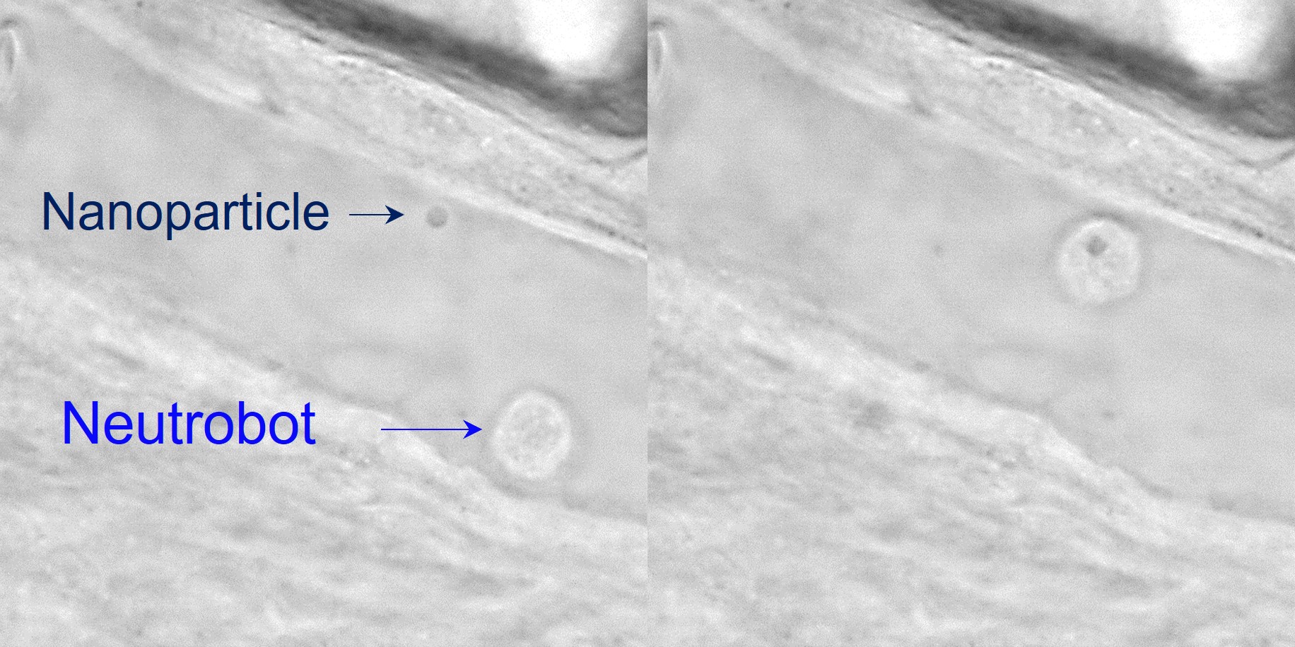 A laser precisely guided a “neutrobot” toward a nanoparticle (left image), which was picked up and transported away