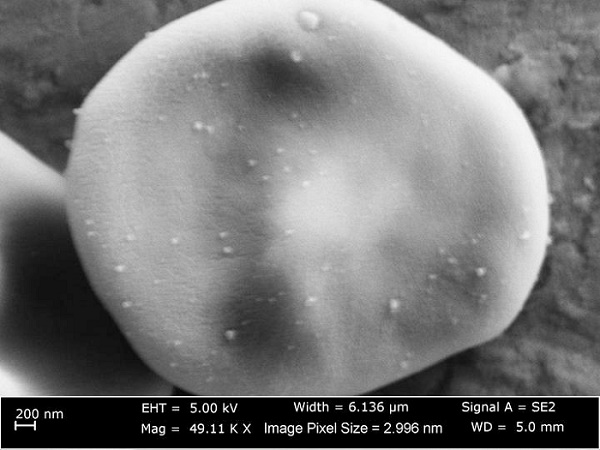 An SEM image of the nanoparticles on the red blood cell