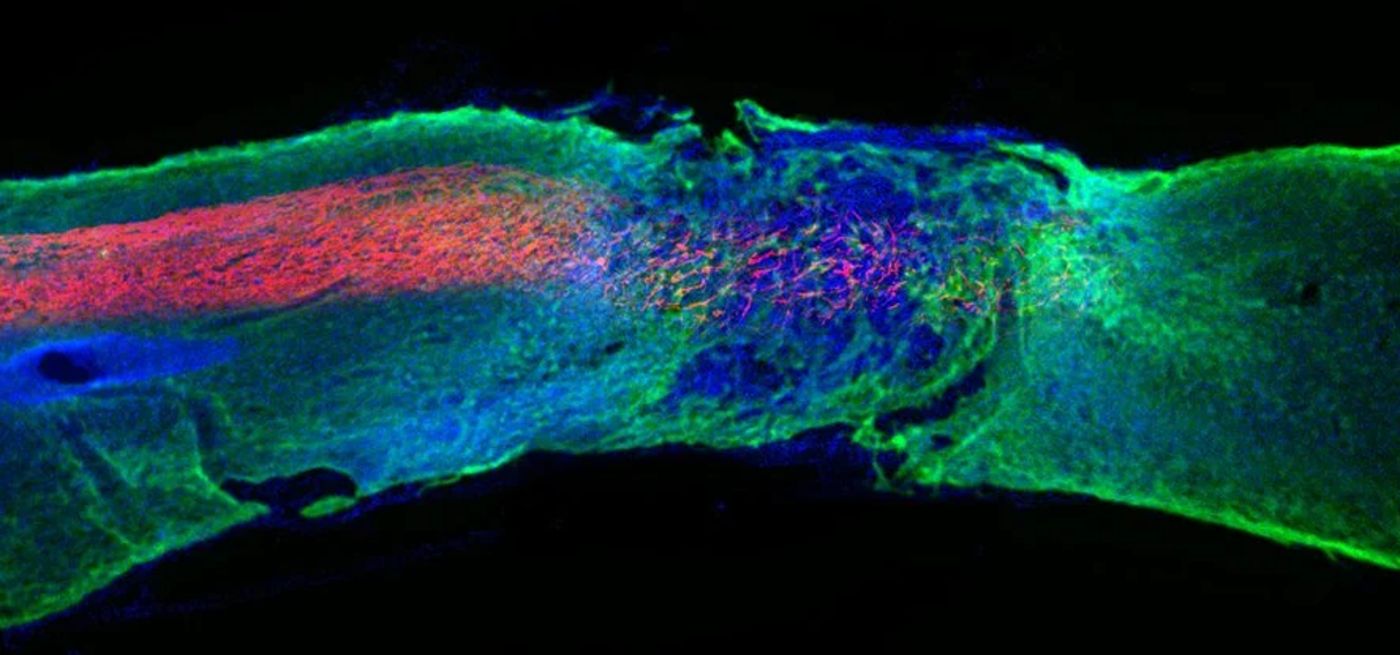 Section of Spine in Green with Red Regenerative Samuel I. Stupp Laboratory. Northwestern University released