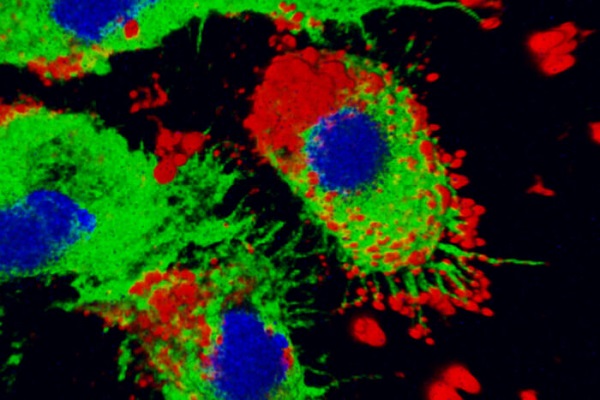 Nanoparticles (red) are taken up by immune cells (green with blue nuclei)