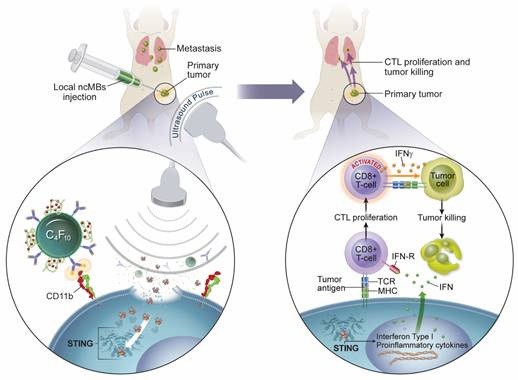 Researchers developed a microbubble-assisted ultrasound-guided immunotherapy to deliver an agent into antigen-presenting cells and enhance the body's innate immune system