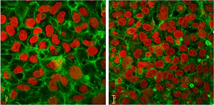 Confocal microscopy images of human lung cells in culture after exposure to the tested materials (left) and control cells