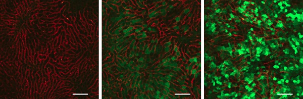 Expression of EGFP (green) in the liver 24 hours after administering LNP-RNA containing EGFP mRNA