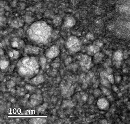 Nanostructured lipid carriers