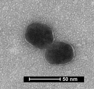 Transmission electron microscope image of gold nanoparticles coated with bacterial Outer Membrane Vesicles