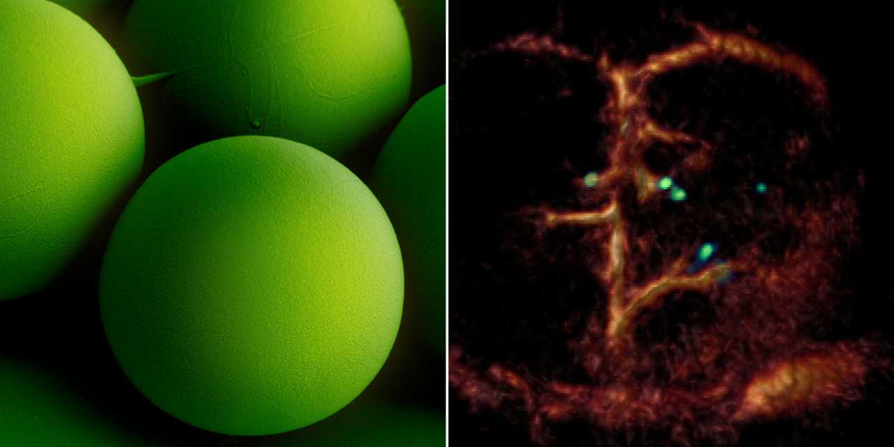 Tiny circulating microrobots, which are as small as red blood cells (left picture), were visualised one-​by-one in the blood vessels of mice with optoacoustic imaging (right picture)