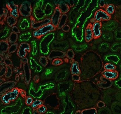 Urine extracellular vesicles (uEVs)