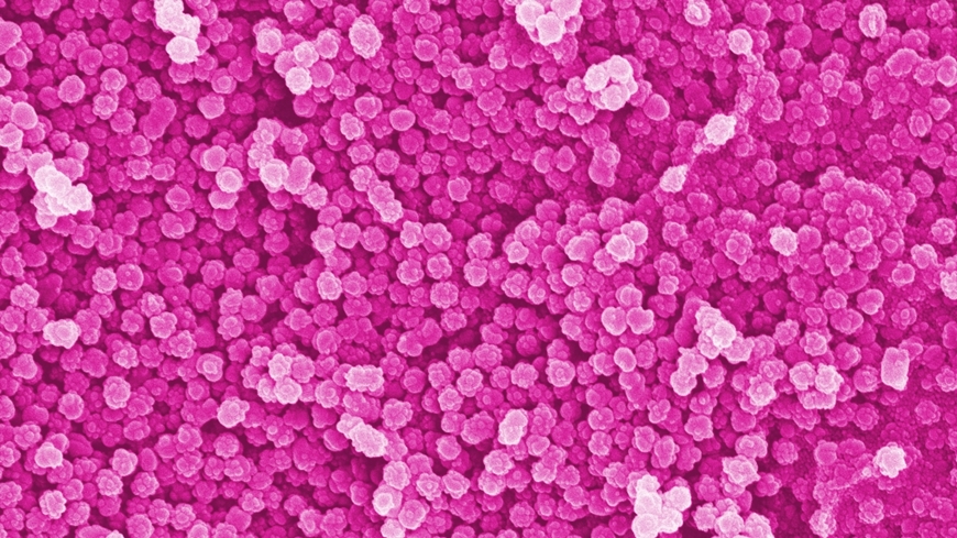 Polystyrene particles in the nanometer range (Electron microscopy image, colored, 50.000x)