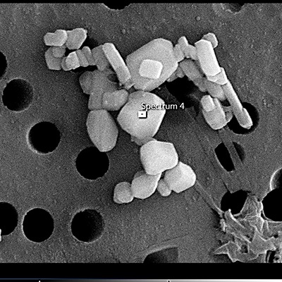 Nanoparticles tend to clump together, as seen in this image of zinc particles taken with a scanning electron microscopy.