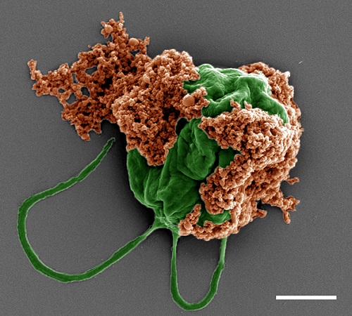 Colored SEM image of a microrobot made of an algae cell (green) covered with drug-filled nanoparticles (orange) coated with red blood cell membranes.
