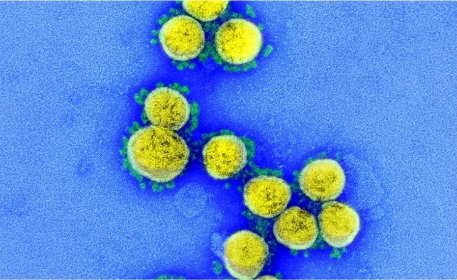 SARS-CoV-2 nanoparticle