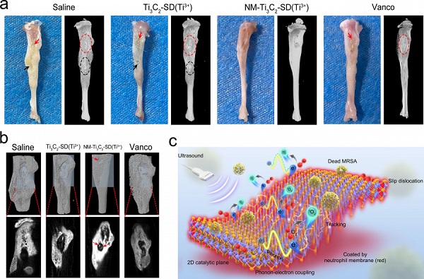 HKUMed invents a novel two-dimensional (2D) ultrasound-responsive antibacterial nano-sheets to effectively address bone tissue infection.