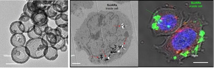 Electron micrographs of SiJAR (left), electron micrographs and fluorescence micrographs of SiJAR-injected cells (right)