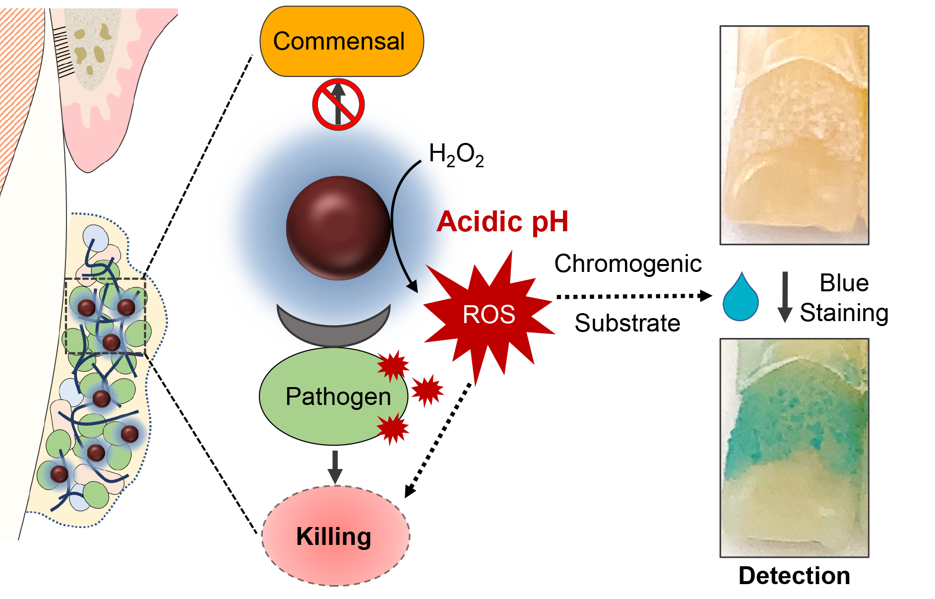 Pairing iron oxide nanoparticles with hydrogen peroxide