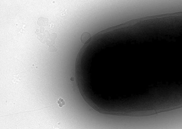 Plasmid DNA entering the E. coli cell after exposure to 18GHz electro magnetic energy.
