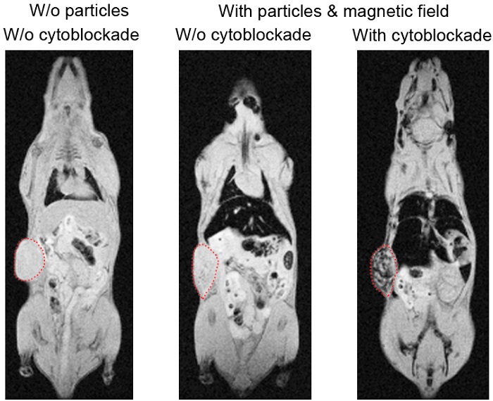 Comparison between magnetic nanoparticle delivery to the melanoma tumor in mice with the use of the cytoblockade technology