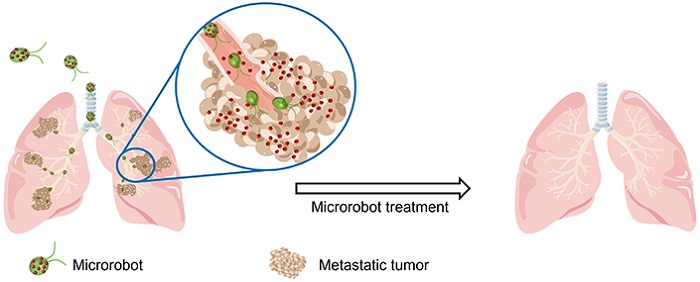 Illustration of the microrobots being administered through the trachea to treat metatstatic tumors in the lungs.