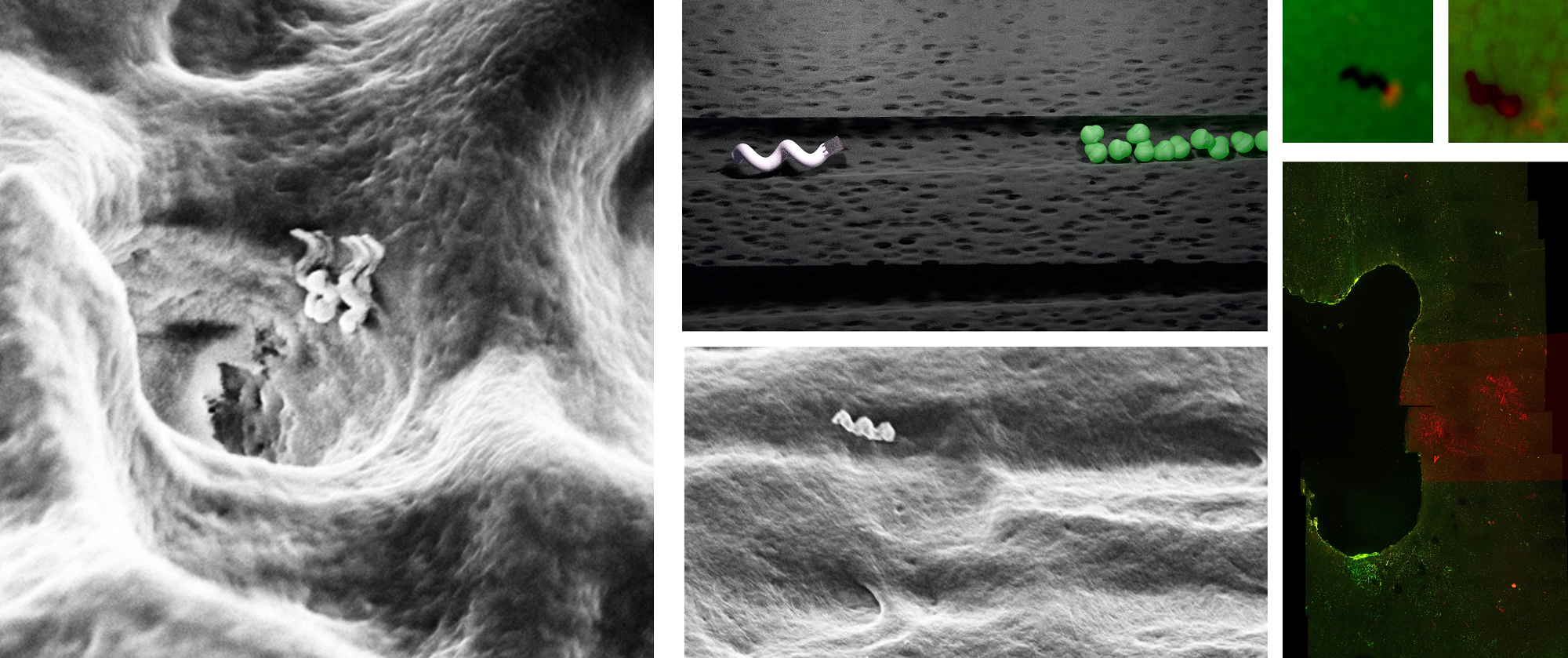 Nanobots entering a dentinal tubule