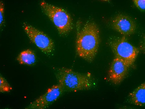 Fluorescence microscopy image showing FuOXP-siRNA nanoparticles (red) effectively taken up by mouse colon cancer cells. Cell nuclei appear as blue circles.