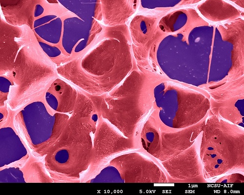 A hydrogel loaded with catalase, developed by Zhuang Liu and his team for potential cancer immunotherapeutic applications.