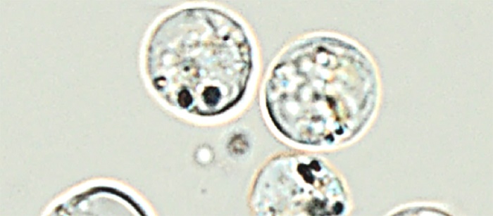 Optical microscopy image of nano-Ag uptake by golden-brown alga Poterioochromonas malhamensis