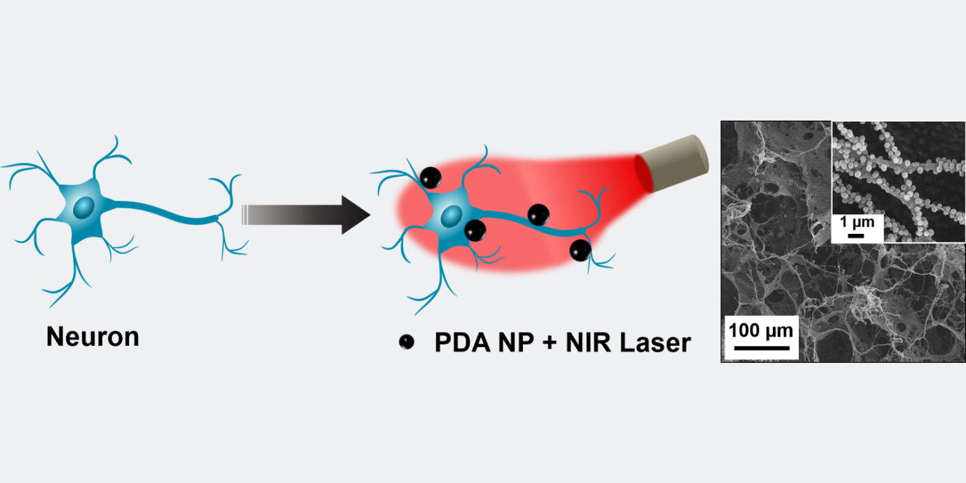 Schematic of polydopamine nanoparticle (PDA NP)-mediated photothermal stimulation of neurons