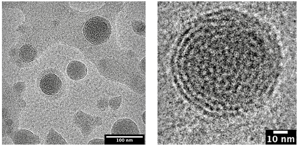 These cryo-electron microscopy images show the multi-layered structures of the lipid nanoparticles that the scientists produced and studied