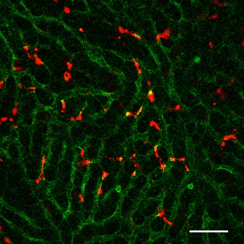 After intravenous injection into mice, STING-lipid nanoparticles (red) transported through blood vessels(green) accumulate in the liver