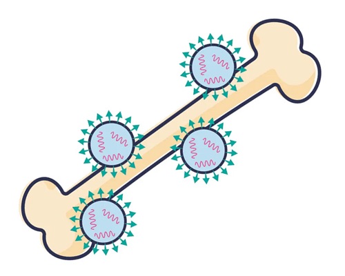 Lipid nanoparticles featuring a bone-binding bisphosphonate molecule help deliver mRNA to the bone