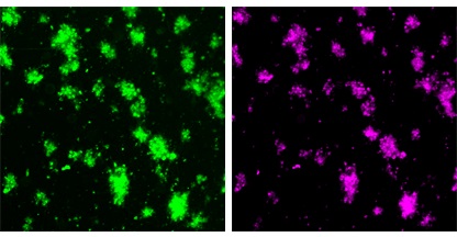 The green image shows the platelet/clot material. The purple image shows particles that have bound to the clot.