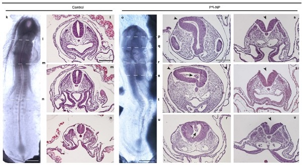 Chick embryos injected with polystyrene nanoplastics (PS-NP) show neural tube defects (arrows; far right panel) compared to untreated controls with full formed neural tubes (left column)