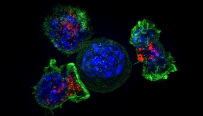 Killer T cells surround a cancer cell