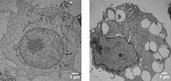 A healthy cell’s internal structure (left) compared to a cell that has taken up nanoparticles coated with DNA (right).