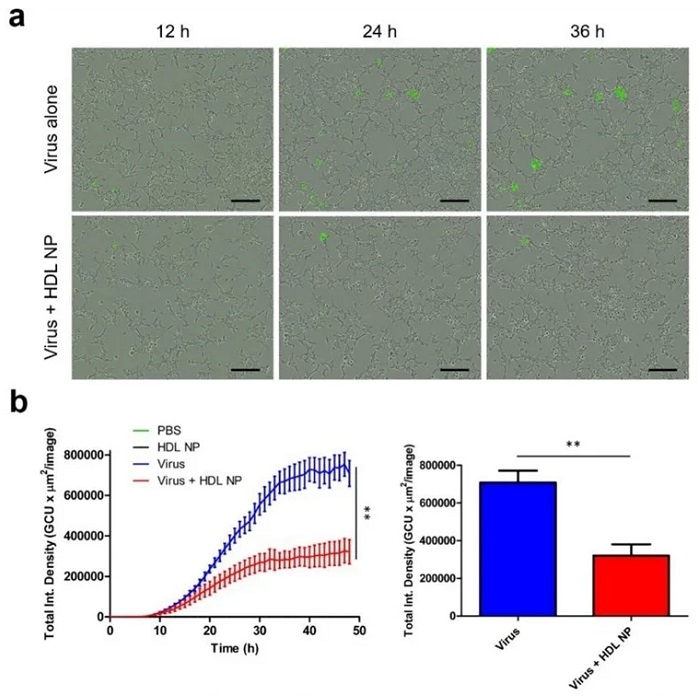 HDL NP treatment inhibits infection of SARS-CoV-2 pseudovirus in HEK293 (ACE2) cells