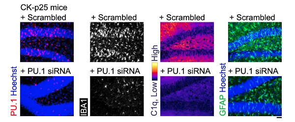 A figure from the paper shows that an siRNA delivered by a lipid nanoparticle was able to reduce expression of the protein PU.1 and other related markers (IBA1, C1q, GFAP) in the brains of mice.