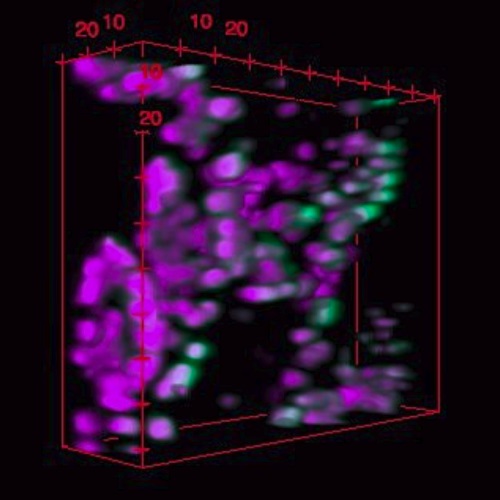 Chloroplasts (magenta color) in leaves expressing a green fluorescent protein