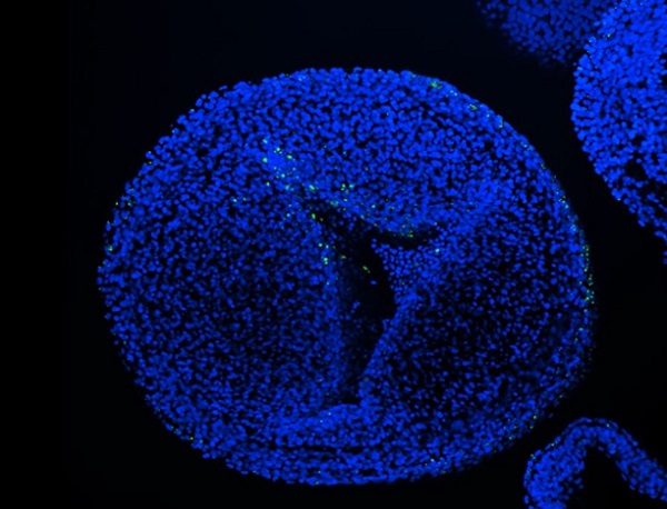 Flecks of nanoplastics (in green) attached to cell (stained blue).