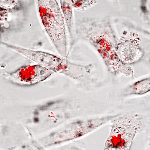 Gold nanoparticle aggregates (red) are observed inside triple negative breast cancer cells after an enzyme-activated assembly and internalization process