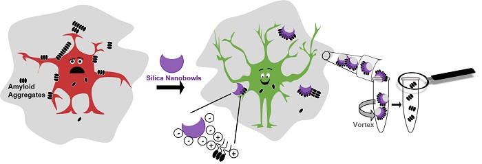 he amyloid beta protein that tangles to form the hallmark Alzheimer’s brain plaques, cling to ultra-small “bowls,” called nanobowls, scientists find