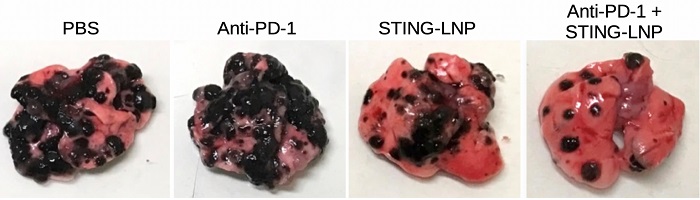 Combination therapy against anti-PD-1-resistant lung cancer